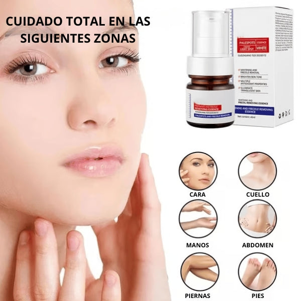 Serum Facial con Vitamina C | Elimina Melasma, Aclara Pecas y Manchas Oscuras al Instante