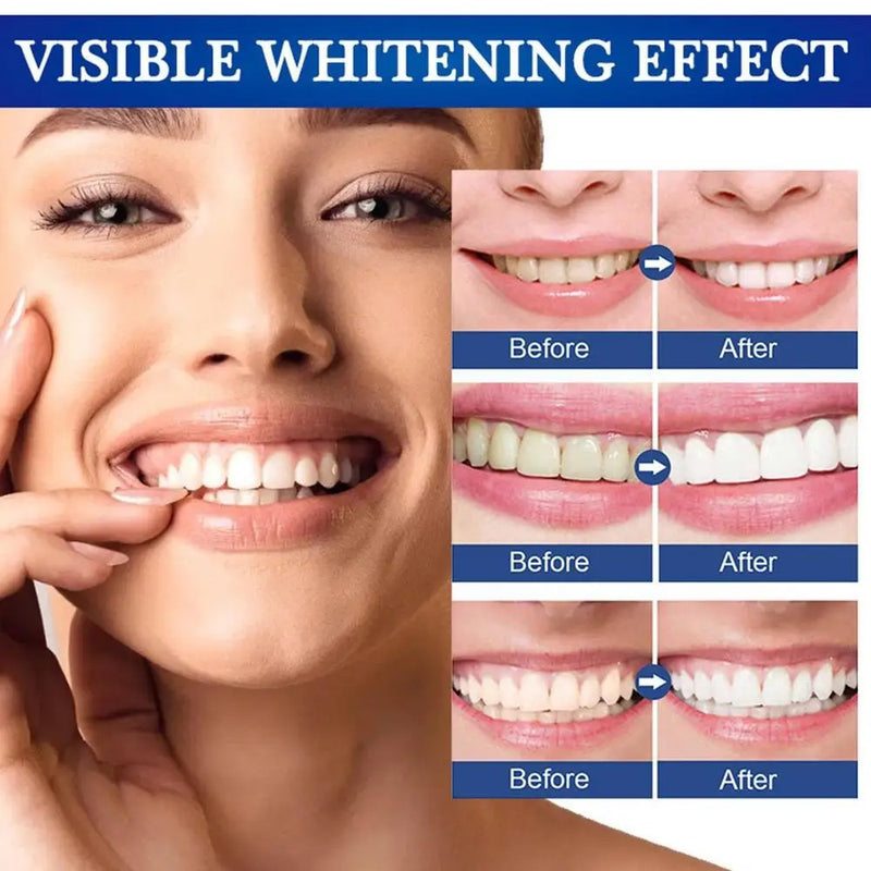 BLANQUEADOR DENTAL WHITENIN