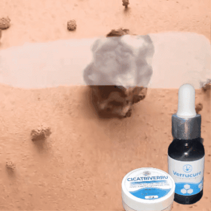 VERRUCURE + CICATRIVERRU DE REGALO 🎁