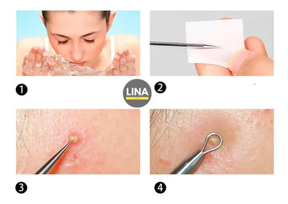 Kit Extractor de Espinillas - ClearSkin